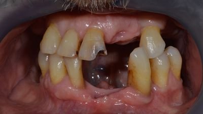 problemi ai denti