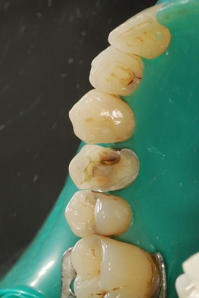 ricostruzione dentale
