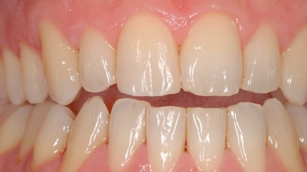 ricostruzioni dentali