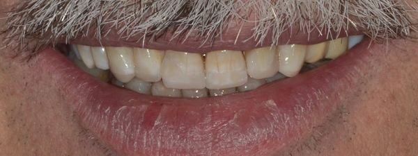 ricostruzioni dentali