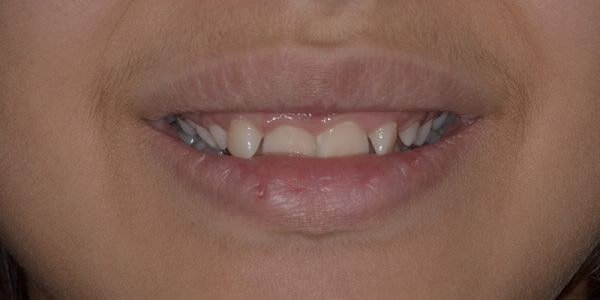 Ortodonzia